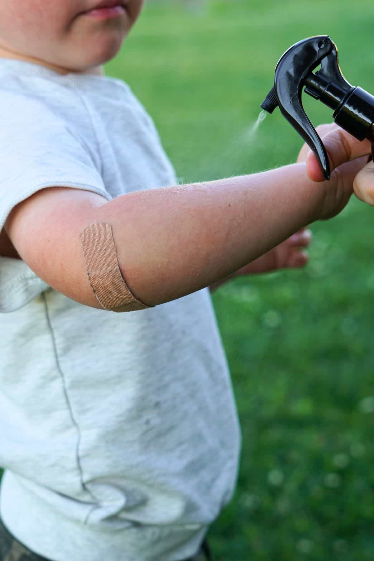 bug spray being sprayed onto child's arm